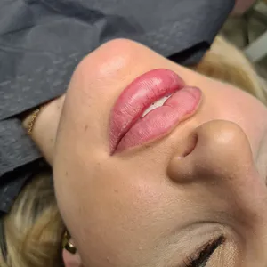 MODELOWANIE UST - Modelowanie ust 1ml - zdjęcie 3