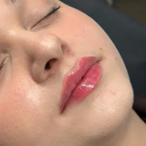 MODELOWANIE UST - Modelowanie ust 0,5 ml - zdjęcie 12