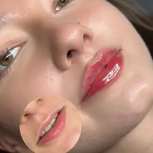 MODELOWANIE UST - Modelowanie ust 0,5 ml - zdjęcie 13