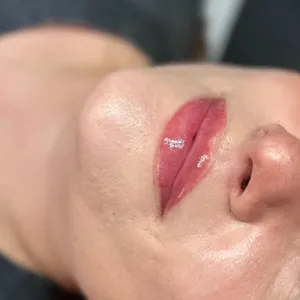 MODELOWANIE UST - Modelowanie ust 0,5 ml - zdjęcie 4