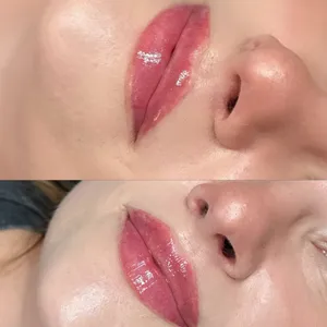 MODELOWANIE UST - Modelowanie ust 0,5 ml - zdjęcie 3